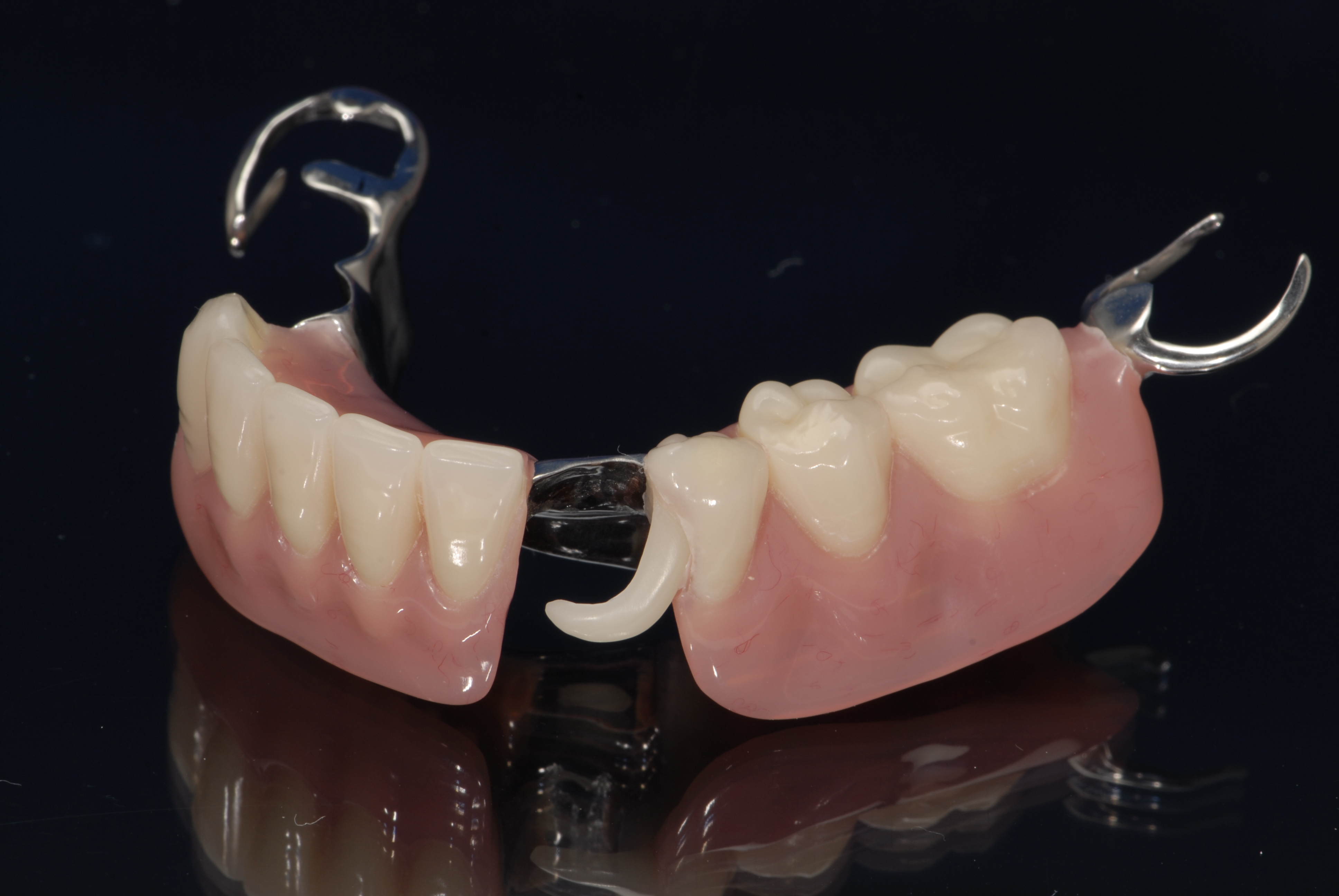 partial denture bottom dentures dental base lab