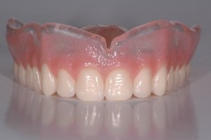 denture dentures partial upper dental conventional base lab materials final teeth adjustments avoid wiand implants anatomy precise